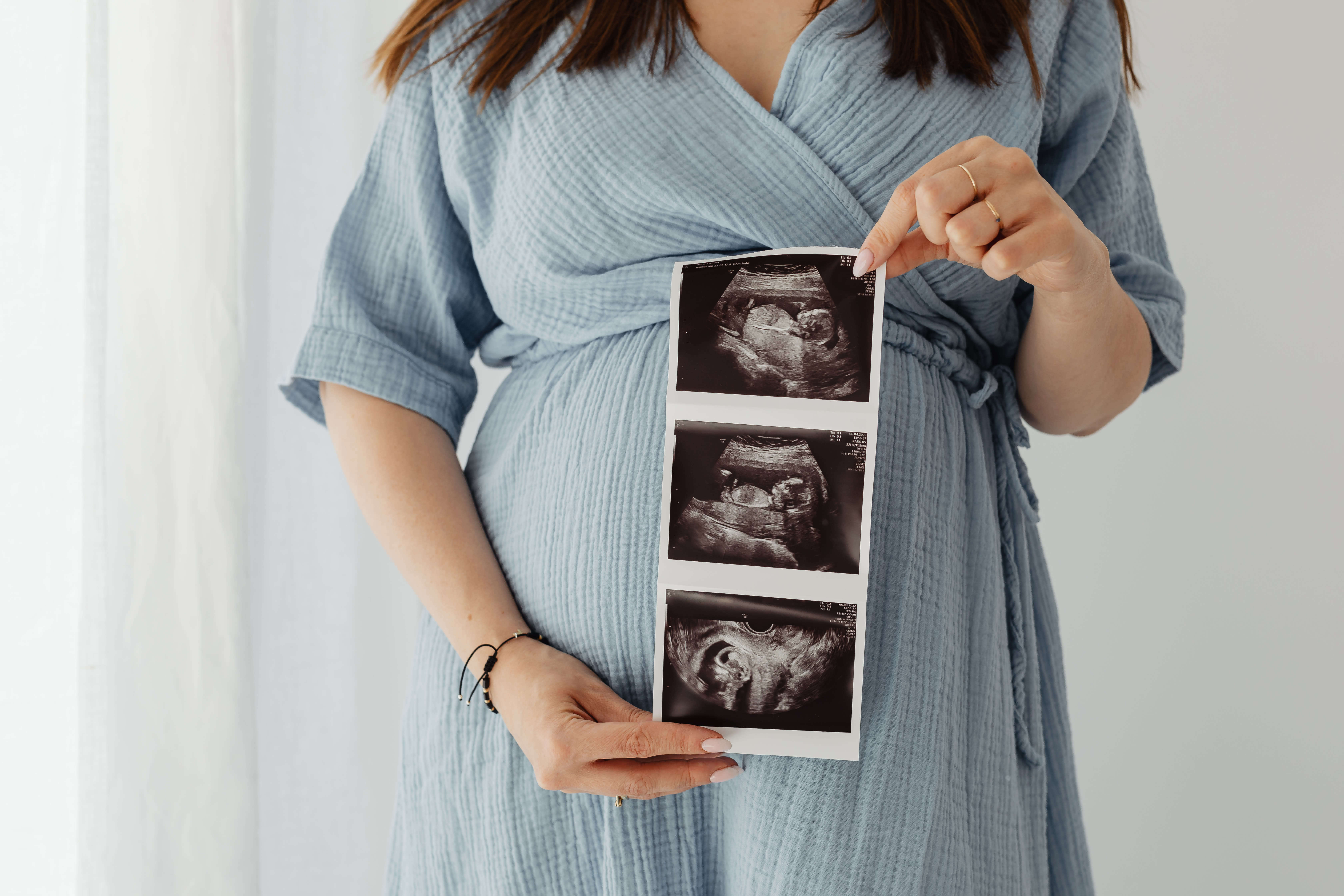 A woman in a light blue dress holds an ultrasound image in front of her pregnant belly, illustrating the stages of pregnancy through three different views of a baby. The woman has long brown hair, and her face is not visible in the image, symbolizing both personal moments and the importance of workplace accommodations.